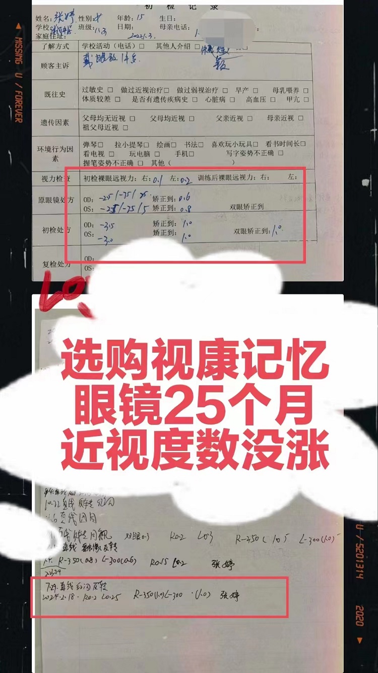 選購(gòu)視康記憶眼鏡25個(gè)月度數(shù)沒(méi)有漲